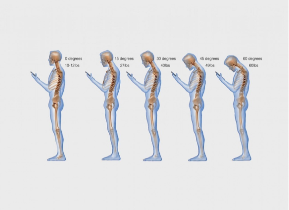 Text Neck Chart